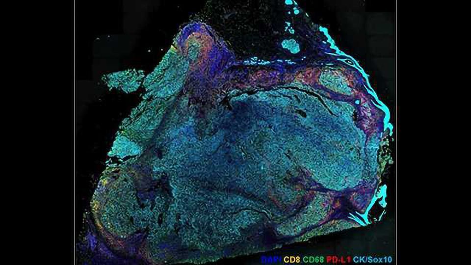 Ultivue launches UltiMapper™ Portfolio of Reagents content piece image