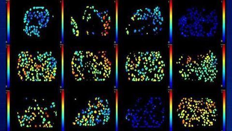 How Well Do Cancer Drugs Hit Their Targets? Here’s How to Find Out