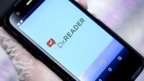 NOW Diagnostics Acquires CELLMIC Reader Technology