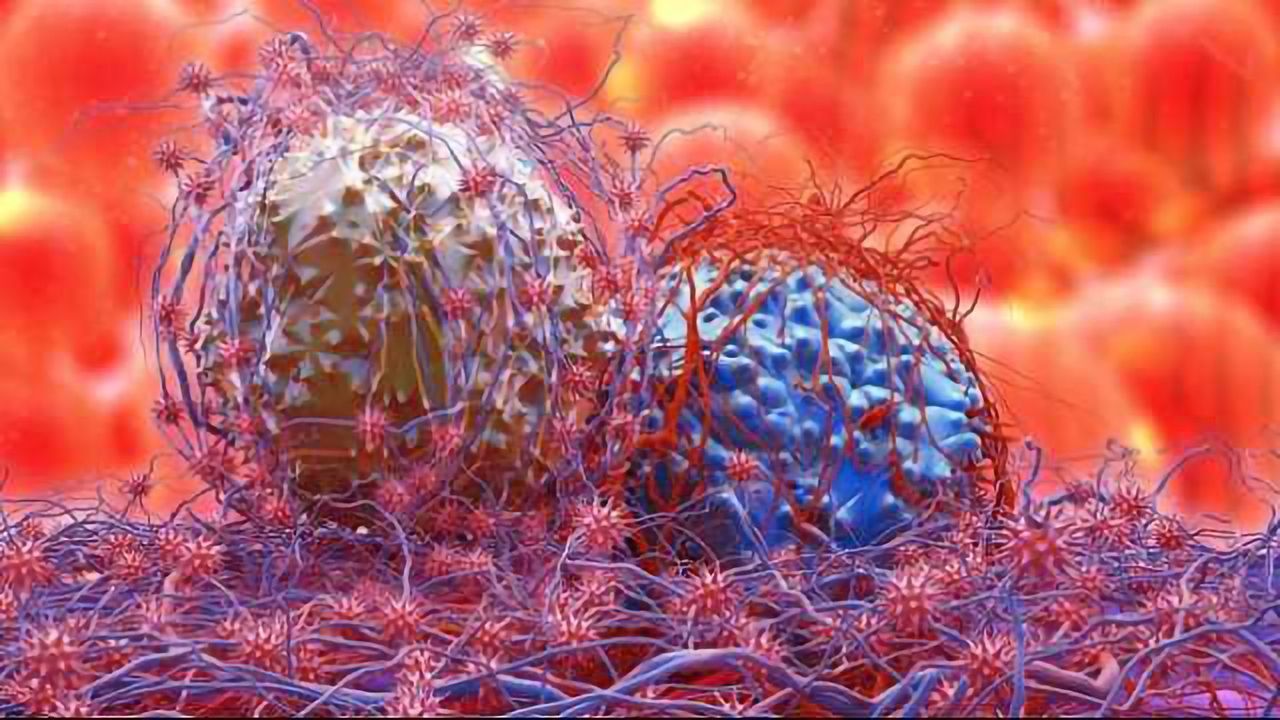 Testosterone Effective at Combating Cachexia in Cancer Patients