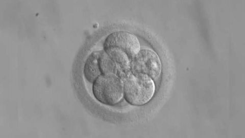 High-Stakes Cellular Process Critical to Small Intestine Development