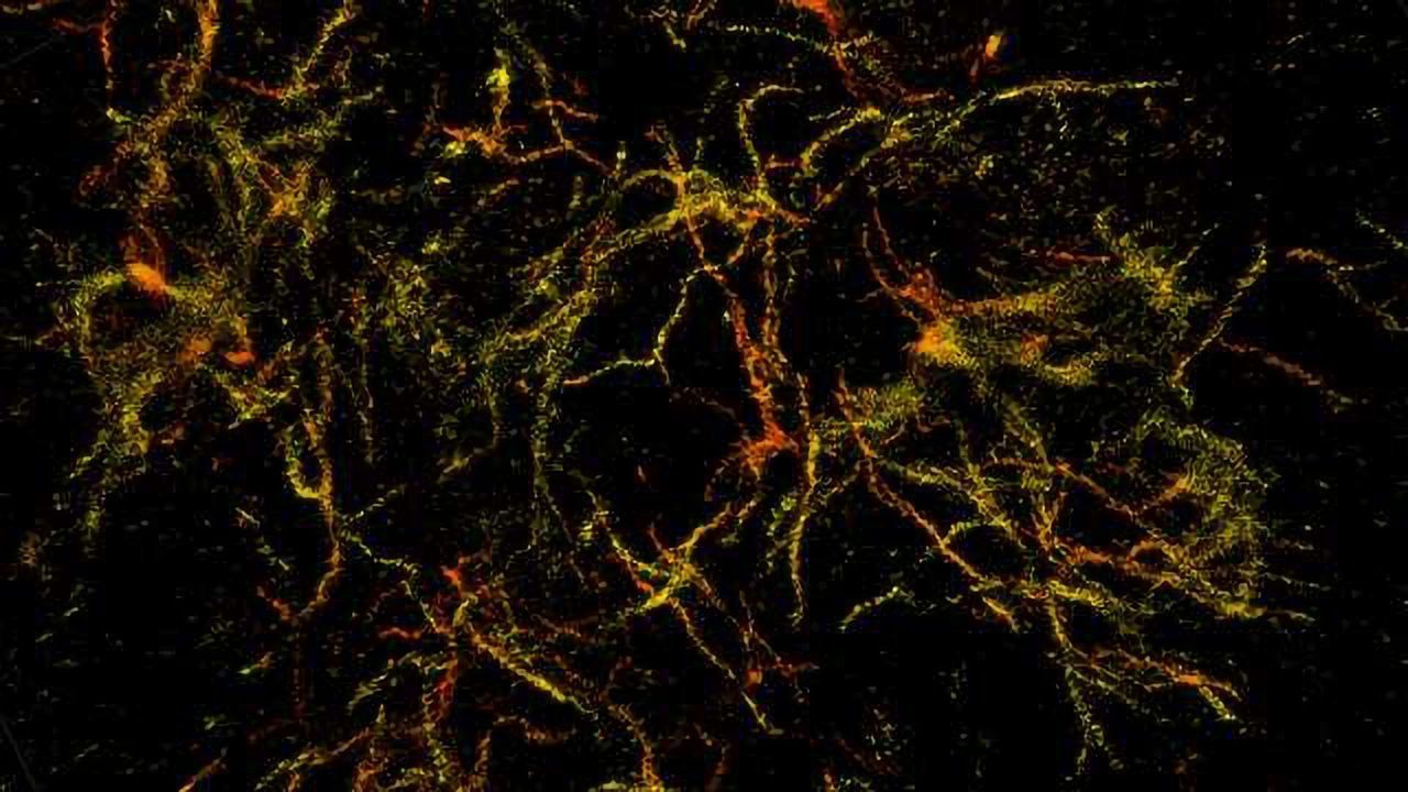 3D Super-Resolution Nanoscopes Used To Identify Amyloid Plaques