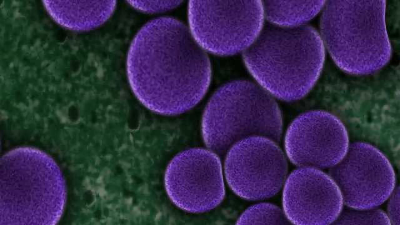 Crowdsourcing Friendly Bacteria Helps Superbug Cause Infection