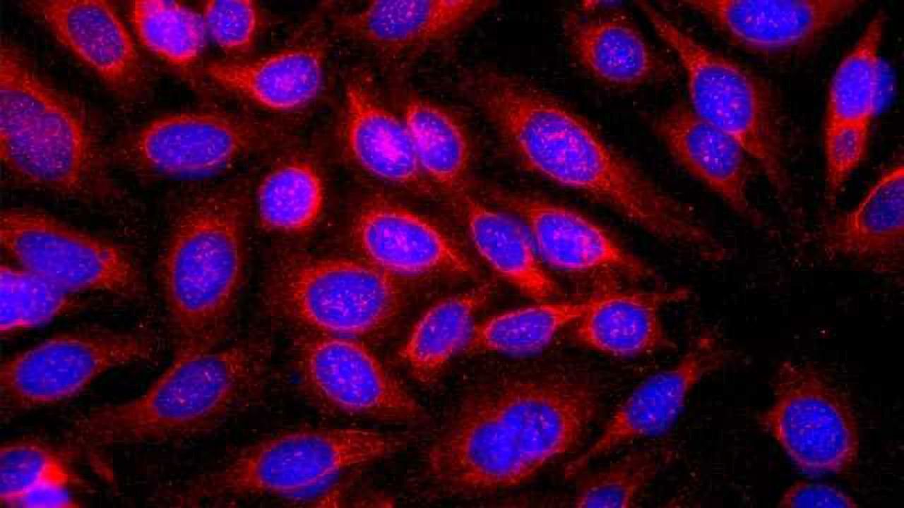 Allergic Responses May Protect Against Skin Cancer