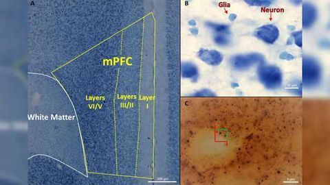 Perinatal Exposure to Phthalates Results in Lower Number of Neurons and Synapses in the Medial Prefrontal Cortex