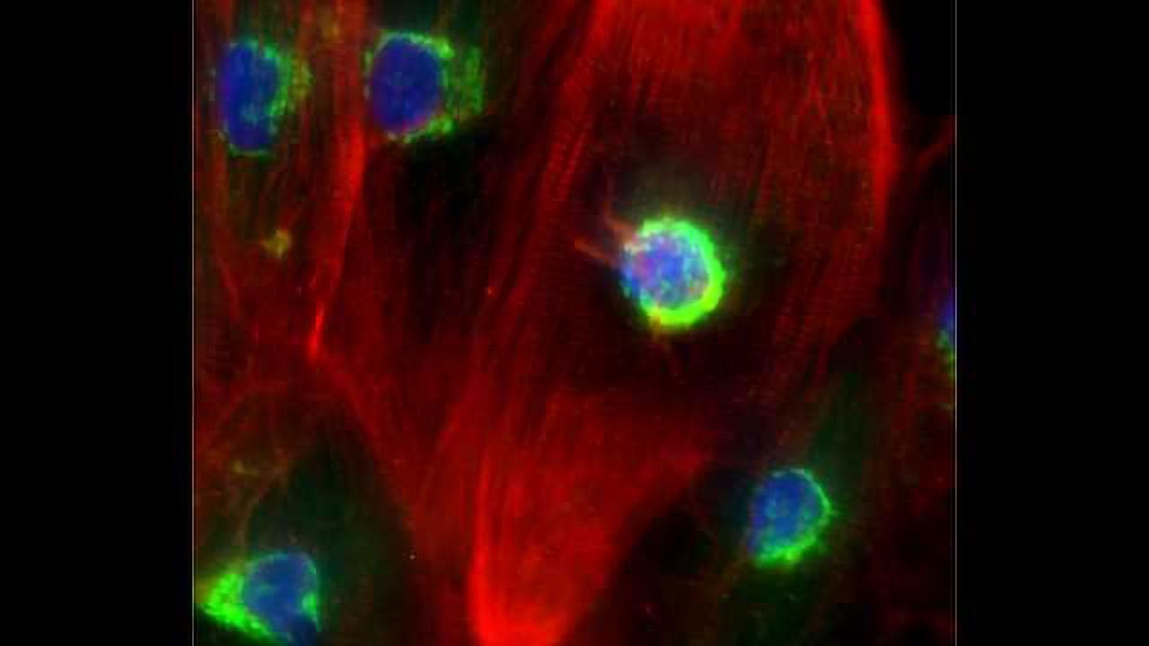 Axol Bioscience Launch Human iPSC-derived Atrial Cardiomyocytes
