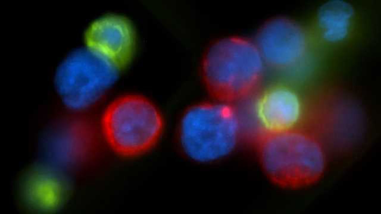 Magnetized Wire Could be used to Detect Cancer in People