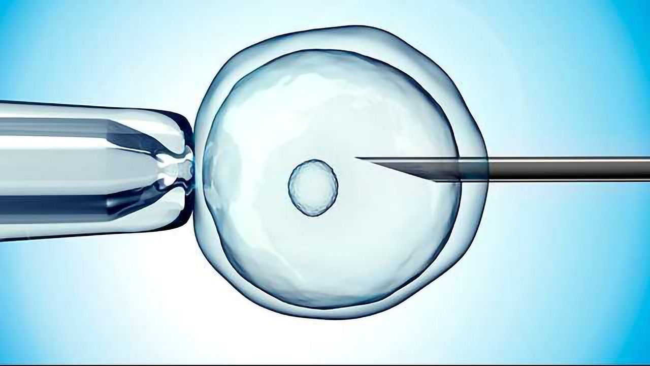 Milestones in IVF