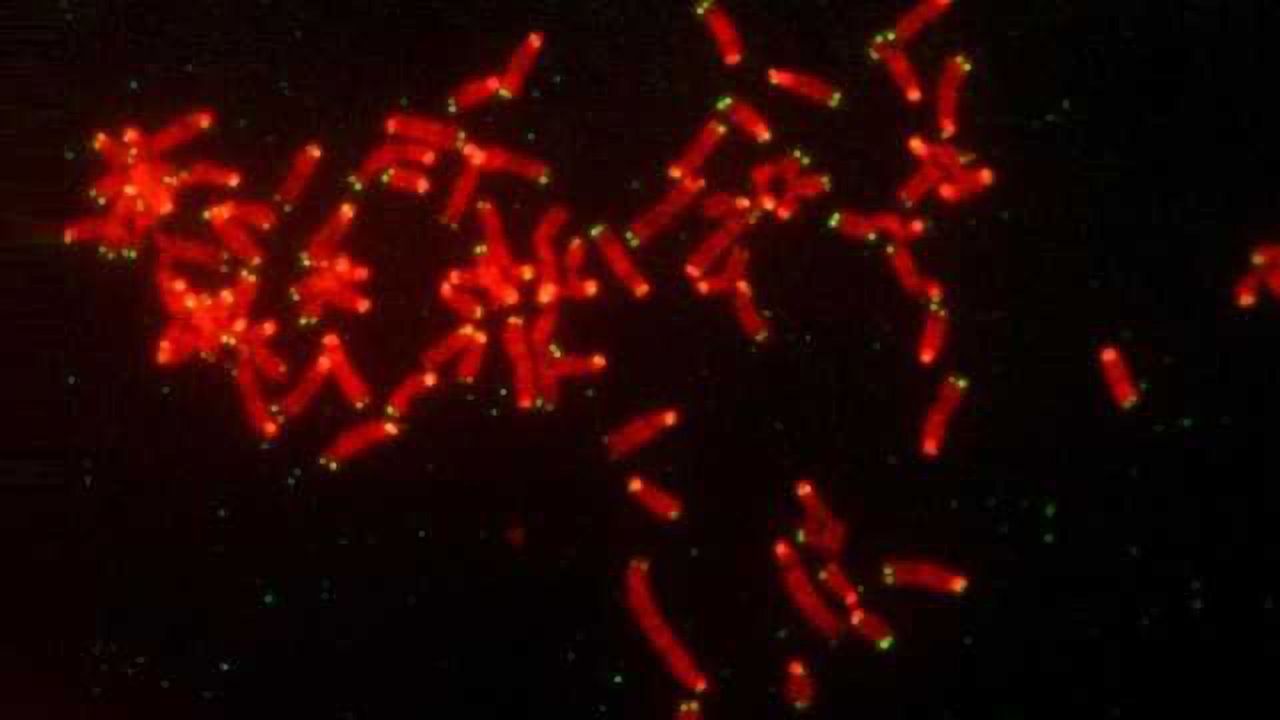 A Mechanism of Drug Resistance in Breast & Ovarian Cancer