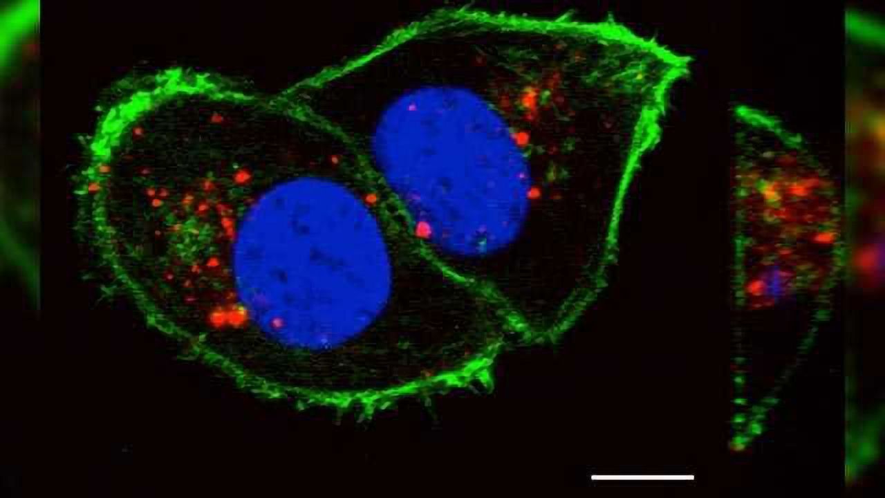 Kidney Cancer Driver Could Lead to New Treatment Strategy