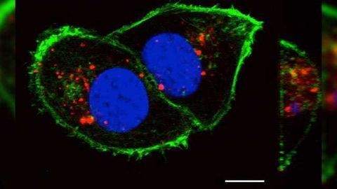 Kidney Cancer Driver Could Lead to New Treatment Strategy
