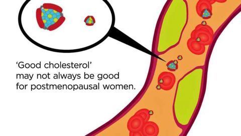 ‘Good Cholesterol’ May Not Always be Good for Postmenopausal Women