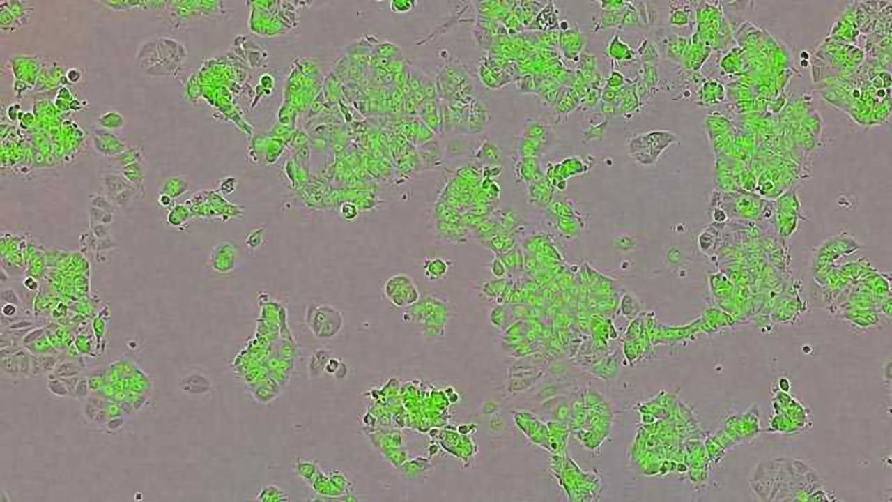 Mysterious Yin Yang Protein Fuels Breast Cancer