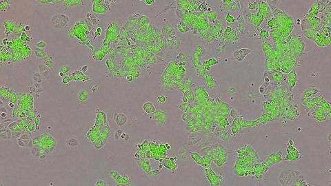 Mysterious Yin Yang Protein Fuels Breast Cancer