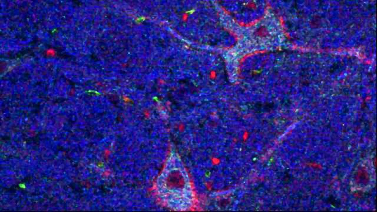 Giant Neurons Play Giant Role in Cognition