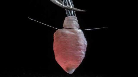 A 3-D Model of a Human Heart Ventricle