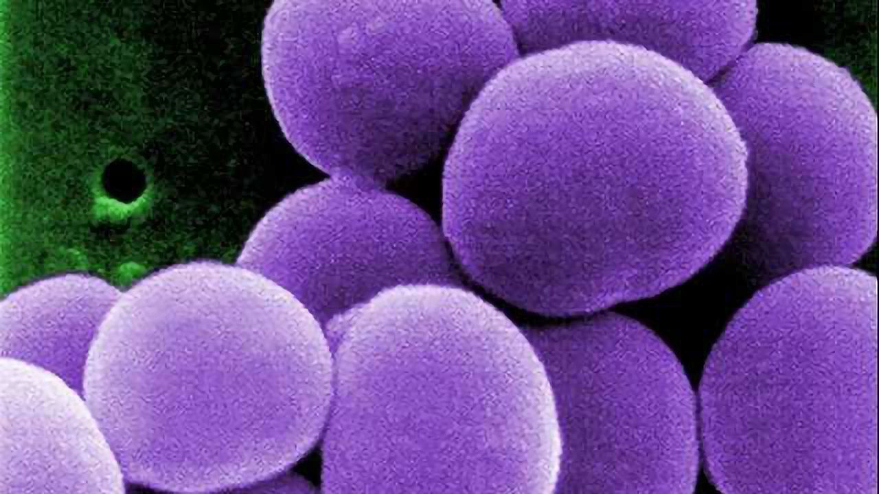 Gene Study Highlights Superbug Link Between People and Animals