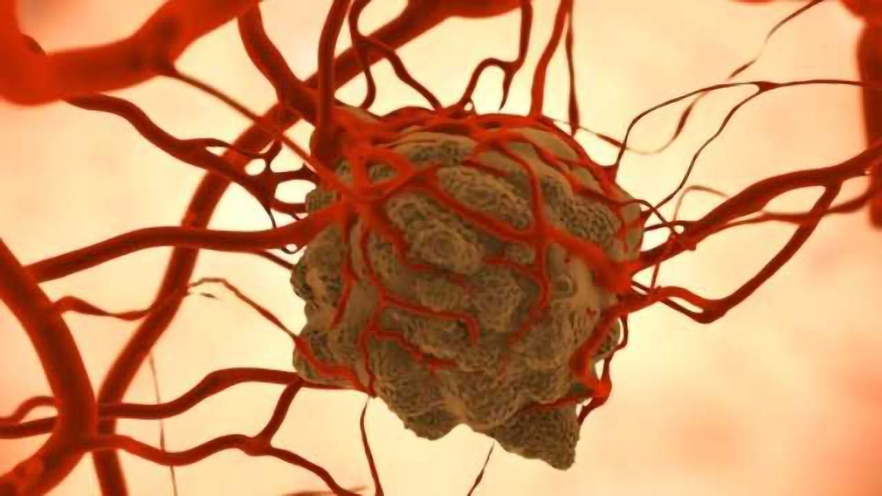 Cancer Therapy Strategy Spells Double Trouble for Tumors