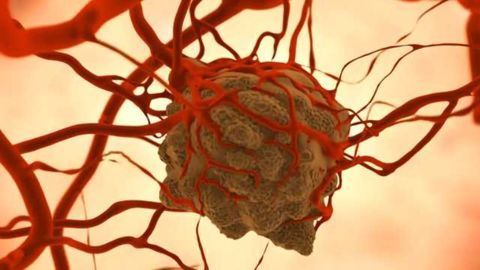 Cancer Therapy Strategy Spells Double Trouble for Tumors