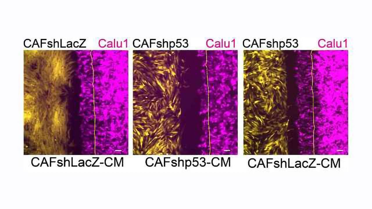 Cancer Causes Cell Defense Protein to Switch Sides