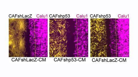 Cancer Causes Cell Defense Protein to Switch Sides
