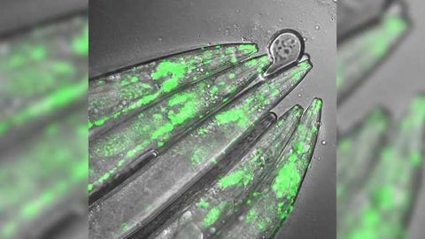 Researchers Reduce Neurodegeneration in Huntington's Stem Cell Model