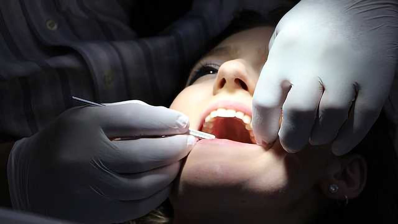 Rare Bacteria that Causes Rampant Tooth Decay Sequenced