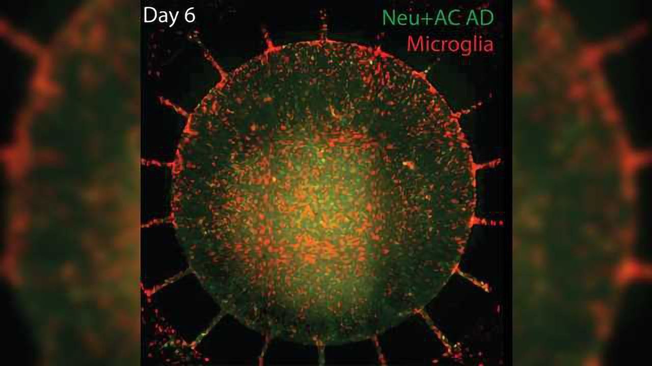 Fully Replicating Alzheimer's Disease in a Dish