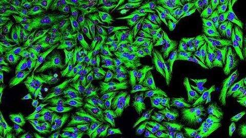 New Cell Lines Produce an Antibody Key for Biologic Drug Production