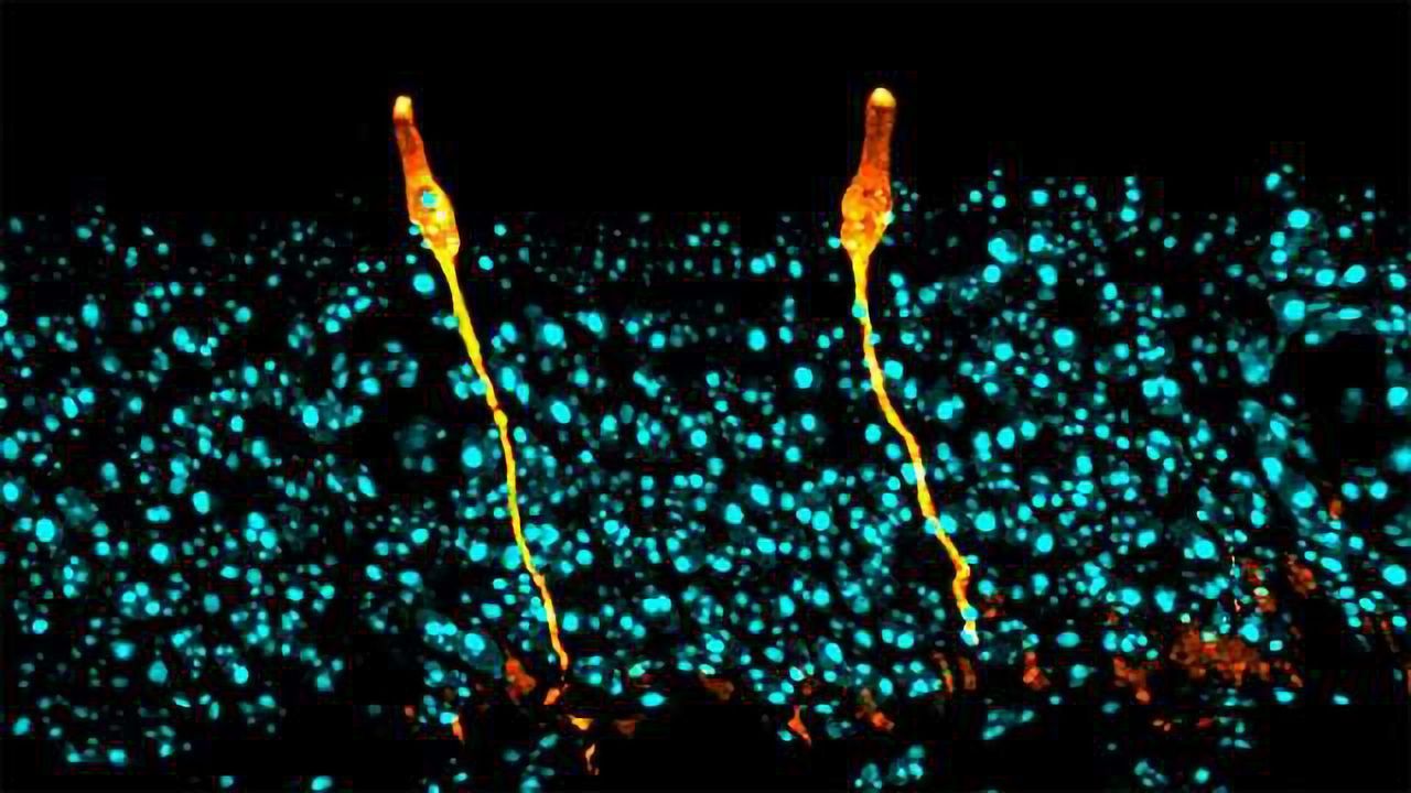 New Lung Cell Type Discovered