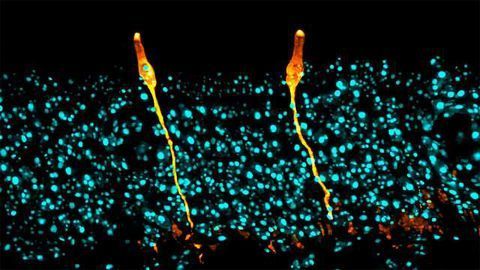 New Lung Cell Type Discovered