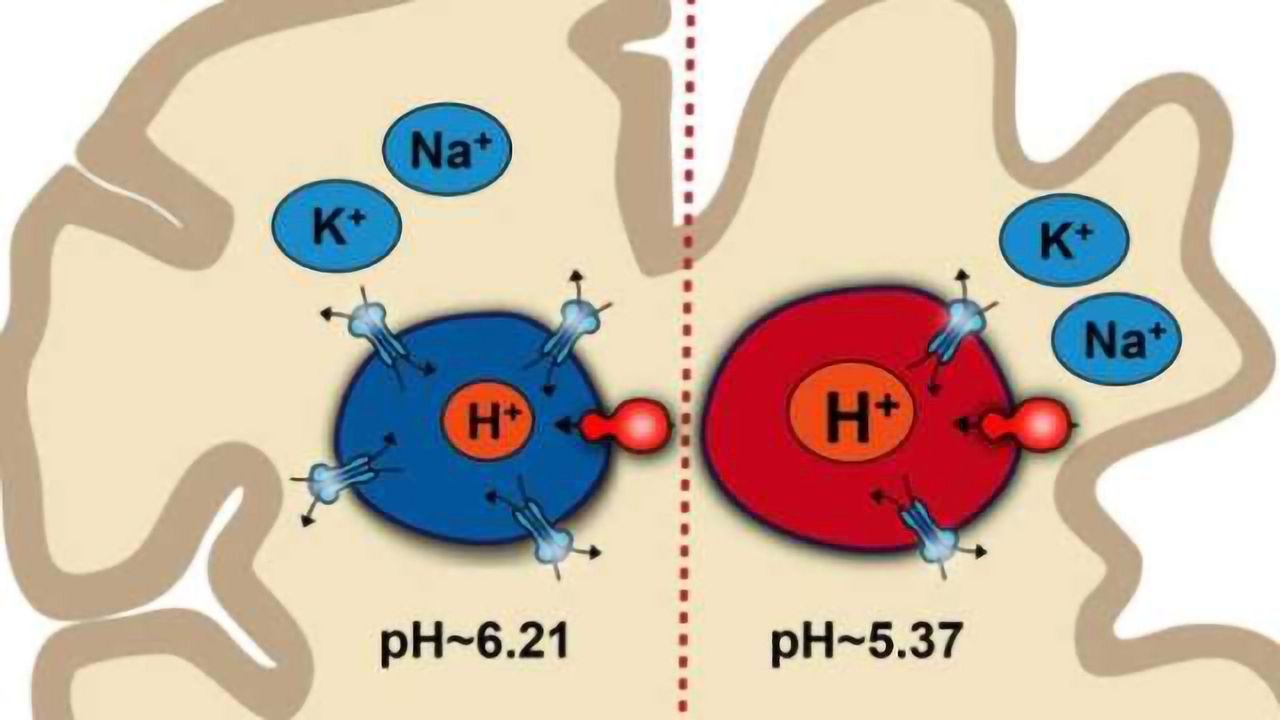 pH Imbalance in Brain Cells May Contribute to Alzheimer’s Disease