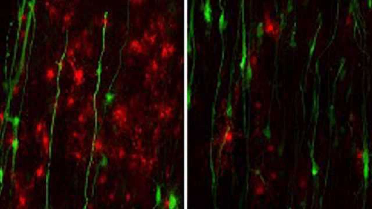 CRISPR Editing in New Stem Cell Line Reveals Pathological Role of Mutant Astrocytes