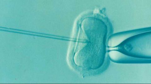 Embryo Screening Does Not Improve Live Birth Rate in IVF