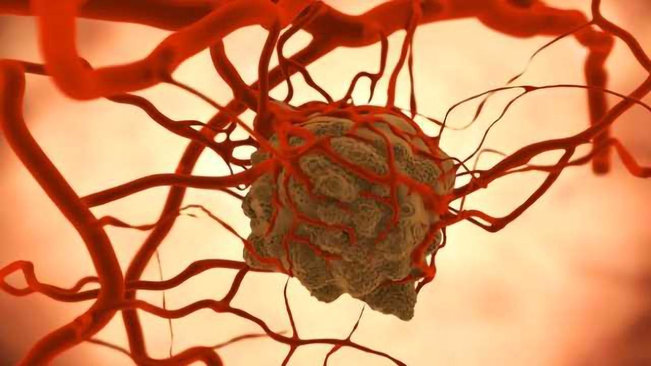 Inhibiting Protein Could Slow Growth of Colon & Rectal Cancers
