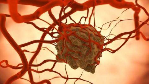 Inhibiting Protein Could Slow Growth of Colon & Rectal Cancers