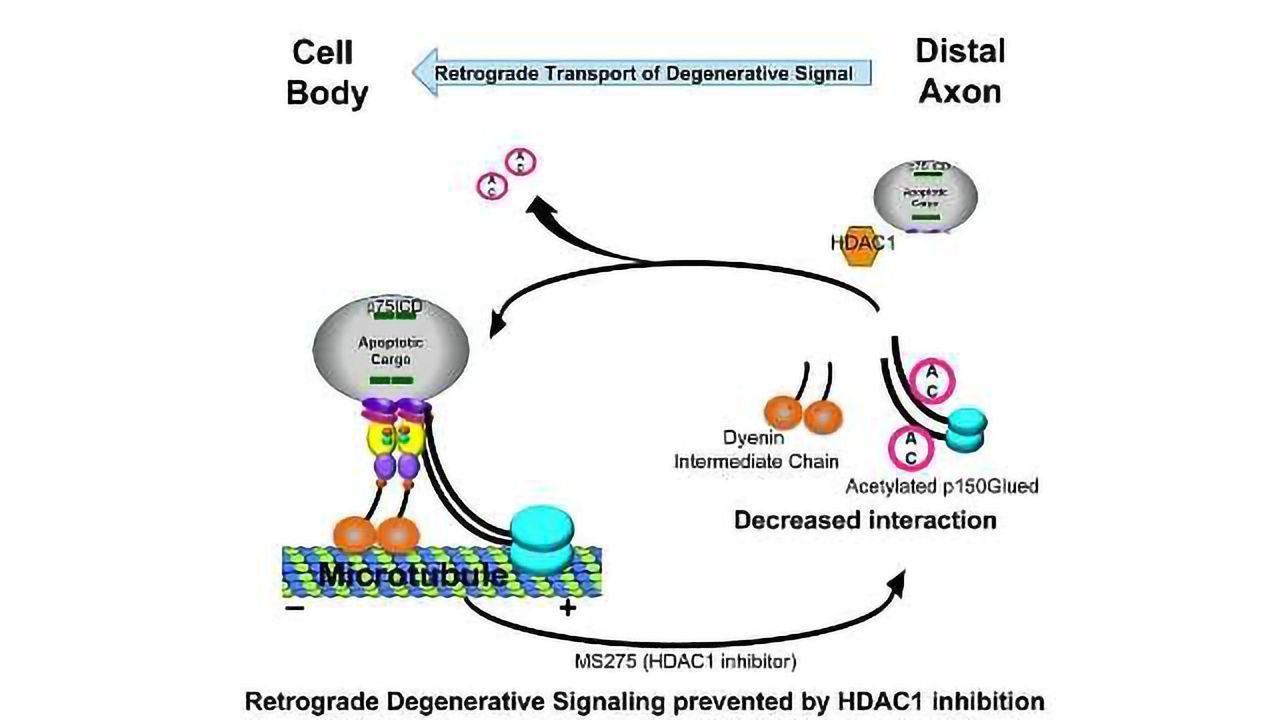 Enzyme Motor Drives Neuron Death