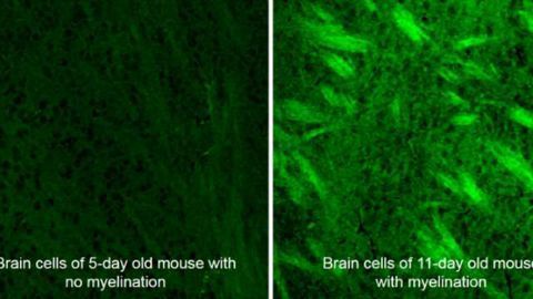 Heavy Water Reveals Cellular Secrets