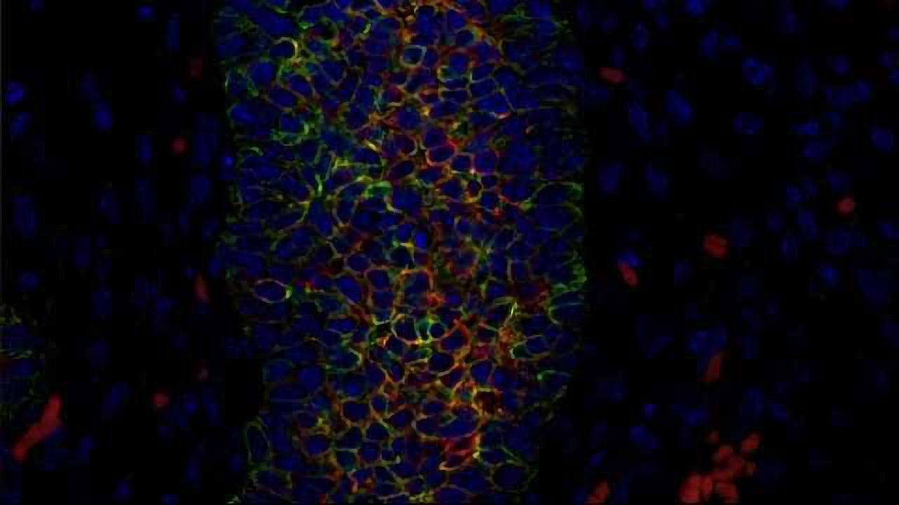Back to the Future: Breast Cancer Repeats Pathways Found in Fetal Cells