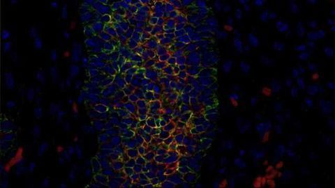 Back to the Future: Breast Cancer Repeats Pathways Found in Fetal Cells