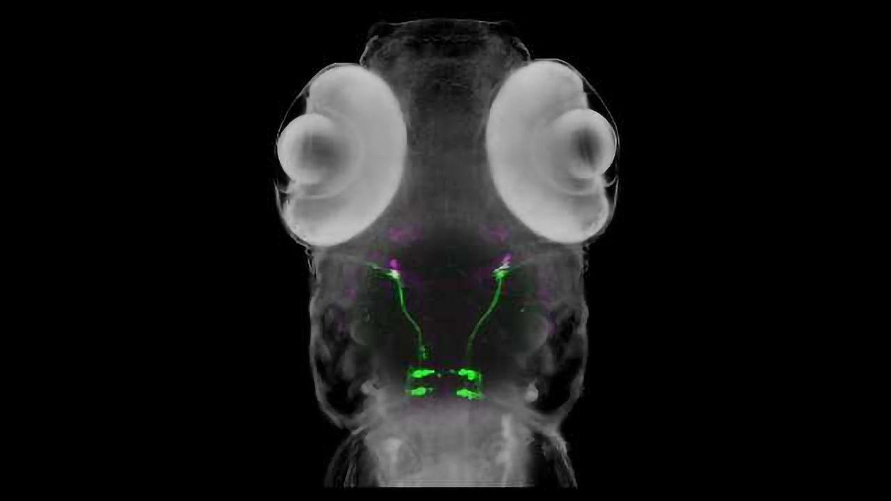 Transparent Zebrafish Help Disentangle 'Crossed Eyes' Genetics