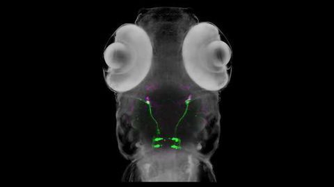 Transparent Zebrafish Help Disentangle 'Crossed Eyes' Genetics
