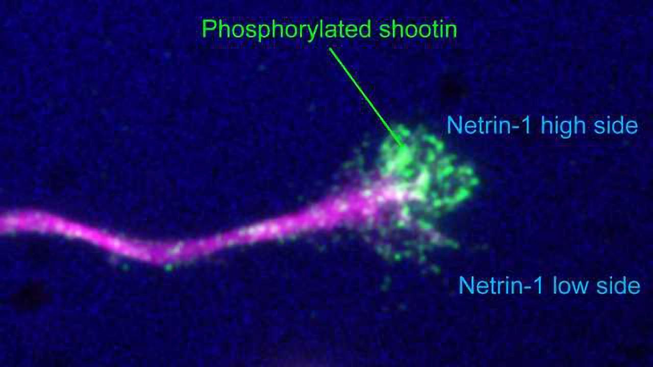 Shootin1 Essential for Axonal Growth Cone Guidance