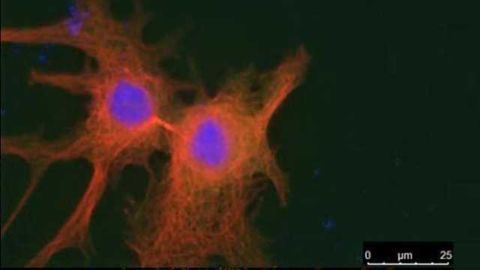 Discovery of Tumor Suppressor Previously Thought to Be an Oncogene