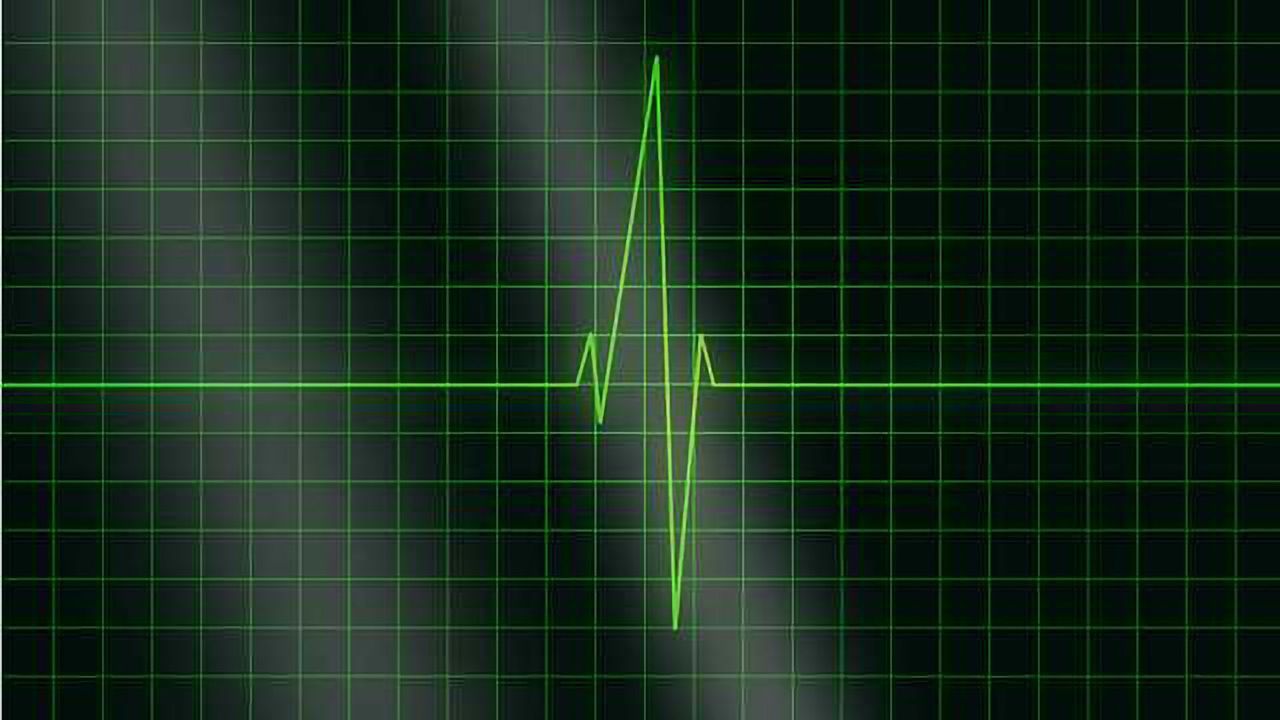 The Need for Speed: Evaluation of a Heart Attack Diagnostic Tool