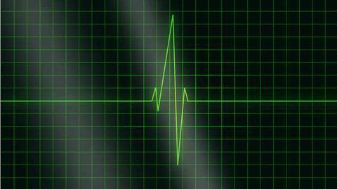 The Need for Speed: Evaluation of a Heart Attack Diagnostic Tool