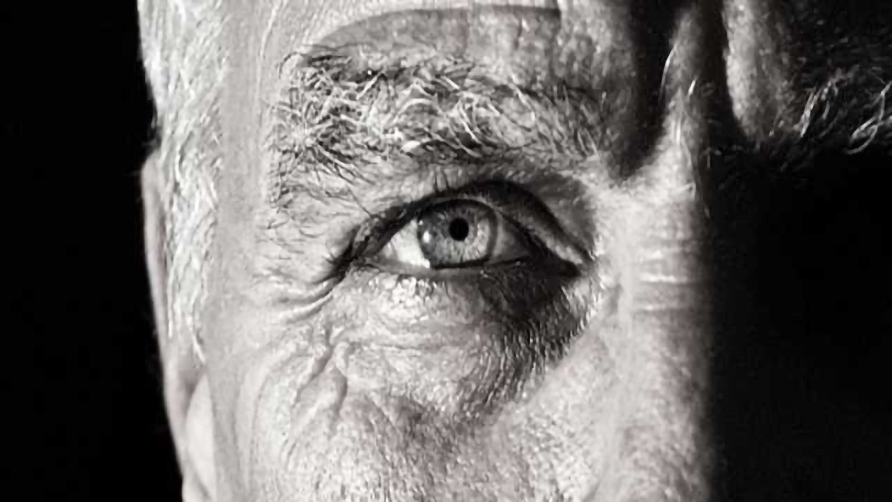 Eye Conditions Provide New Lens for Screening for Alzheimer’s