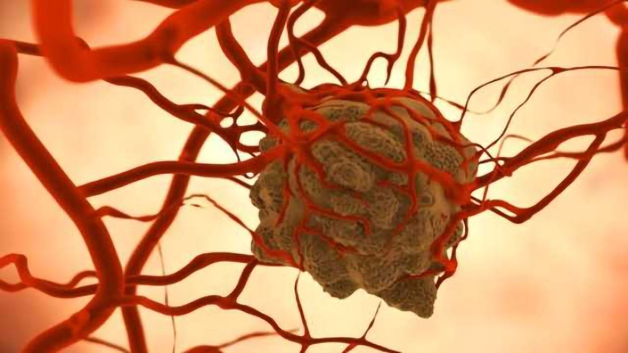 Anticancer Drugs Delivered by a New Drug Delivery System Reduce Tumor Size