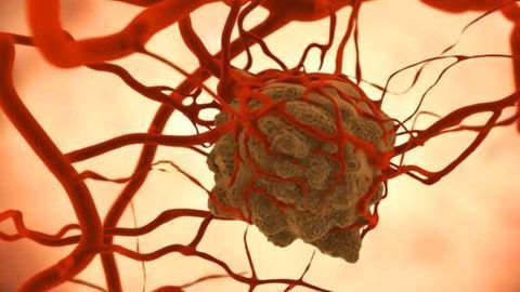 Anticancer Drugs Delivered by a New Drug Delivery System Reduce Tumor Size