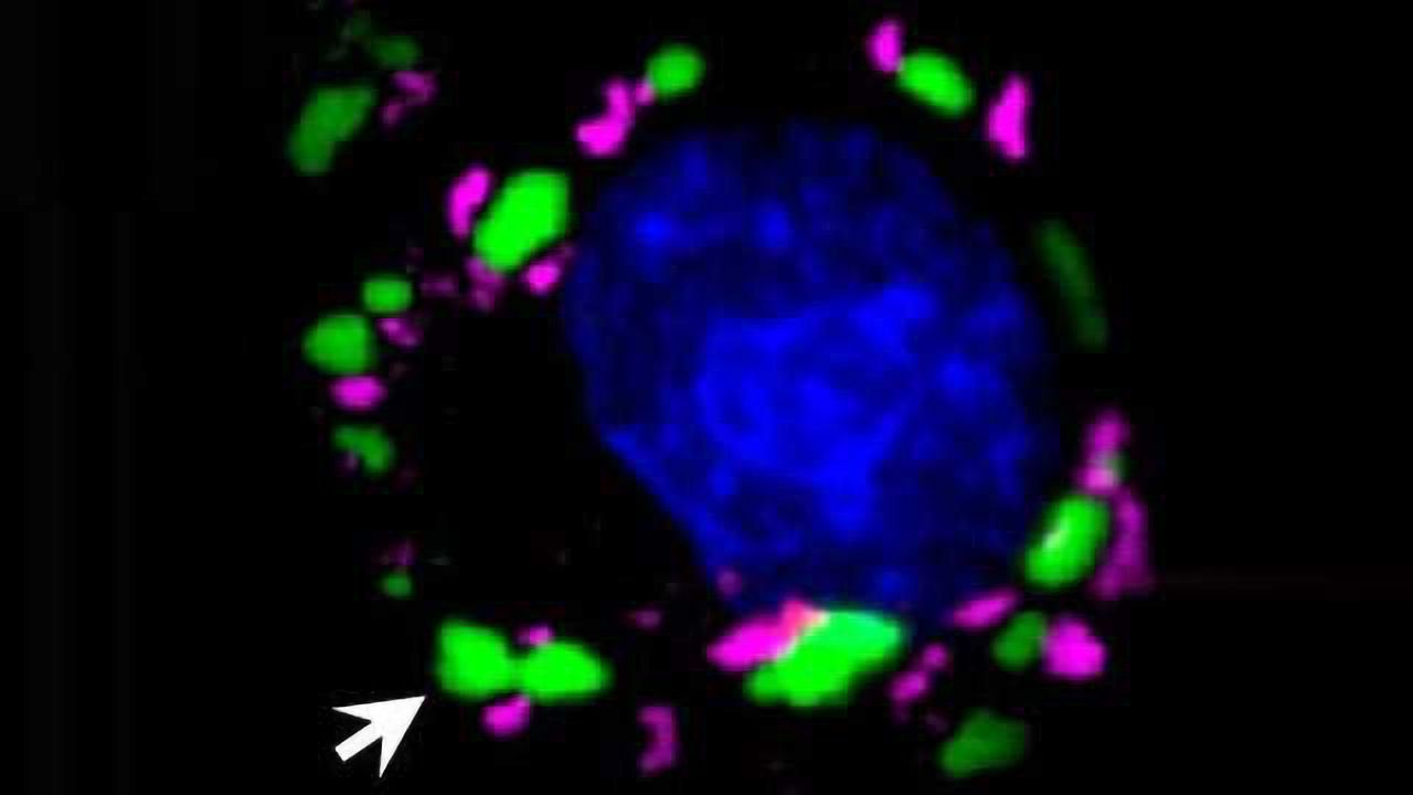Drugs in Development for Cancer May Also Fight Brain Diseases